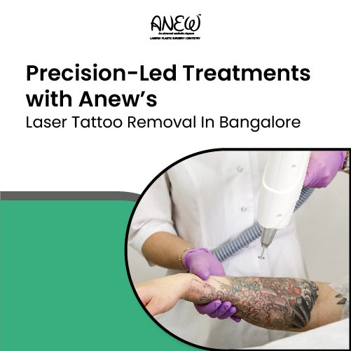  laser tattoo removal in bangalore
